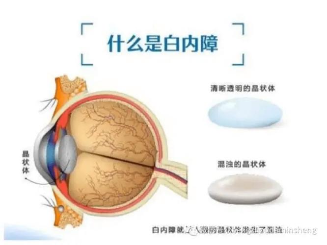 2025新澳最新资料大全和被精神病患挖伤双眼与被精神病患挖伤双眼怎么办