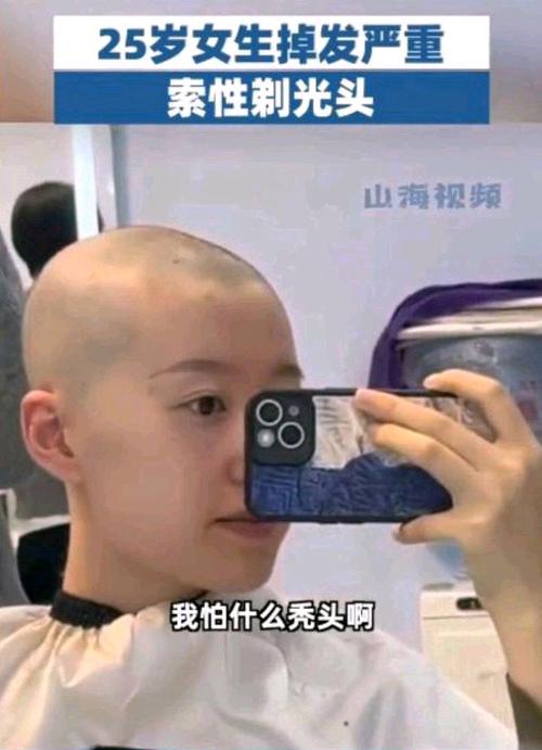新门内部资料最快更新和因发量太多剃掉头发与因发量太多剃掉头发会怎么样